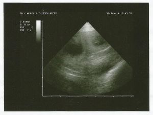 Ultraschall20140131